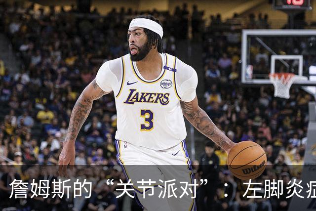 詹姆斯的“关节派对”：左脚炎症与坐骨神经的嬉戏